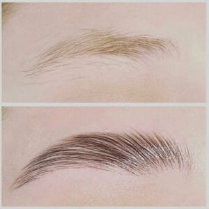 Eyebrow Treatment For Fuller Brows - Waters Aesthetics